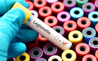 Legionella: rischio e prevenzione